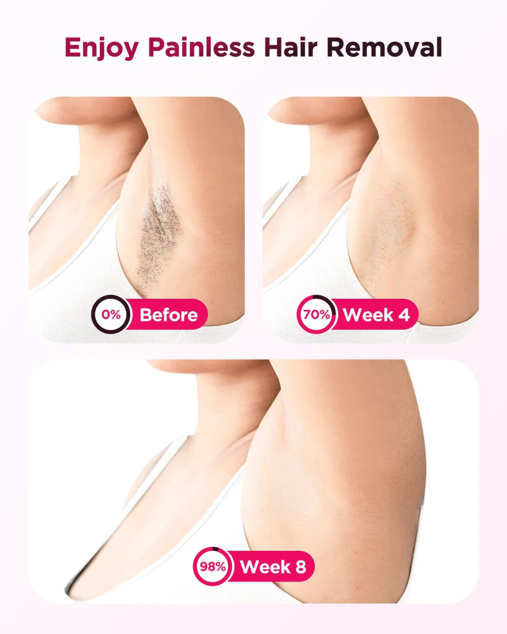 Ice-Cooling IPL Hair Removal Device